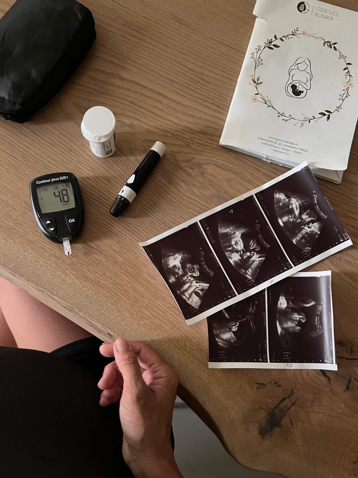 gestacinis diabetas cukrus ryte